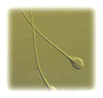 Un Espermatozoide. Pincha y vers el rgano reproductor masculino
